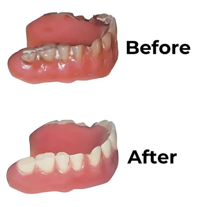 Denture CleanPro™