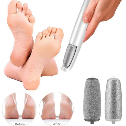 Electric Callus Remover