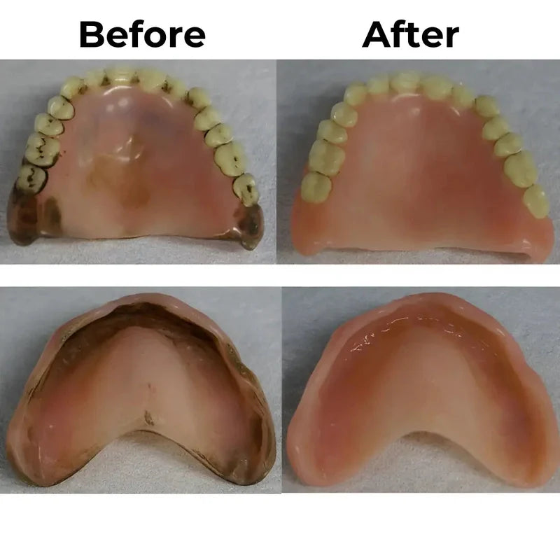 Denture CleanPro™