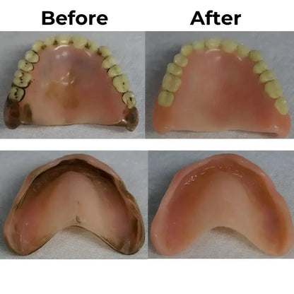 Denture CleanPro™