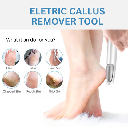 Electric Callus Remover